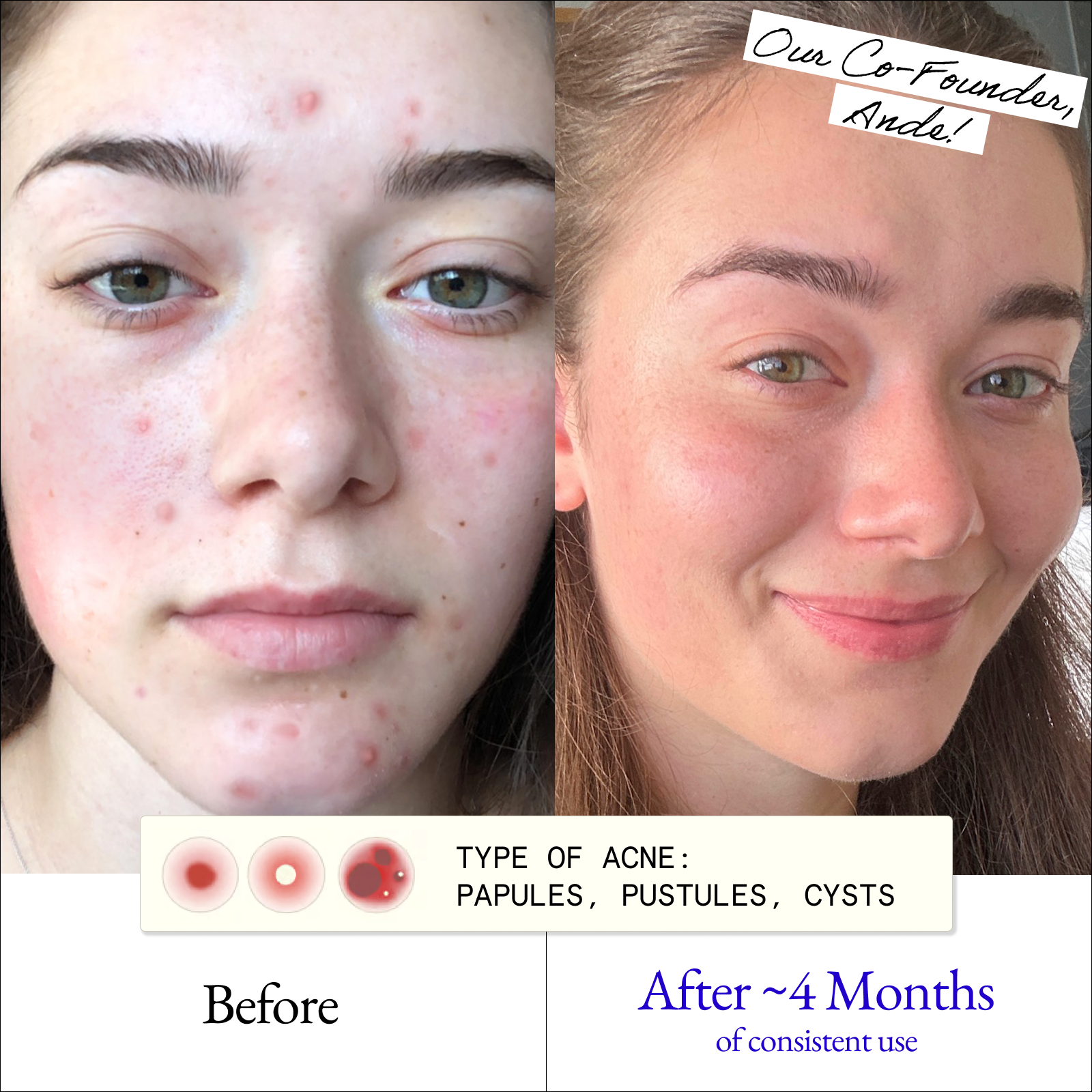 Clarify & Control Protocol (+ Free Eye Cream)