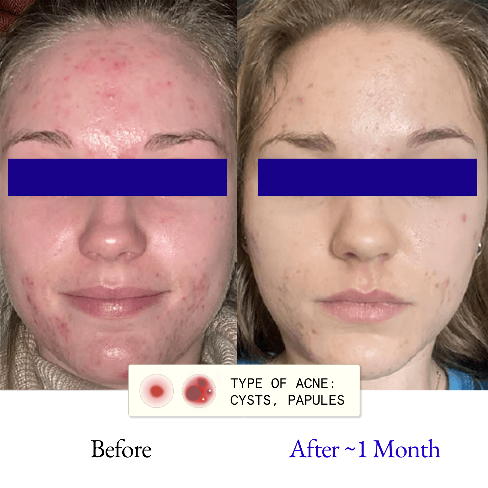 Clarify & Control Protocol (+ Free Eye Cream & Bag)