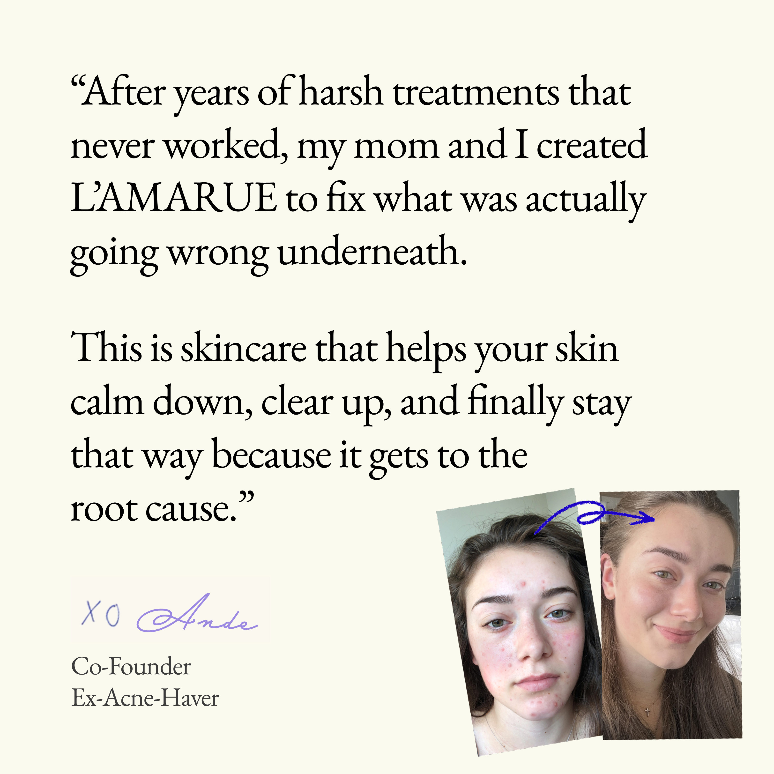 Clarify & Control Protocol (+ Free Eye Cream & Bag)