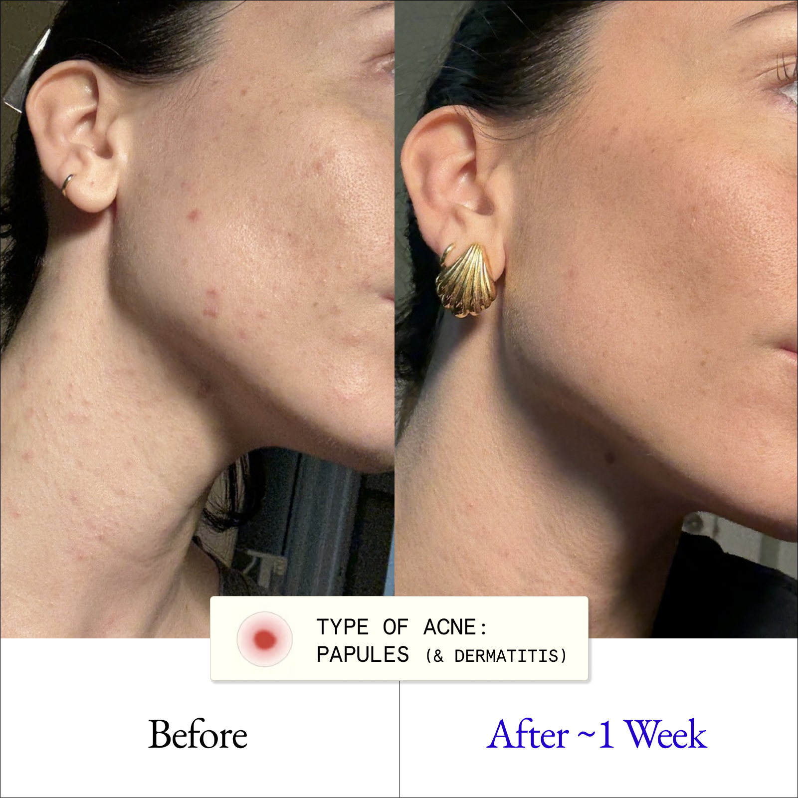 Clarify & Control Protocol (+ Free Eye Cream)