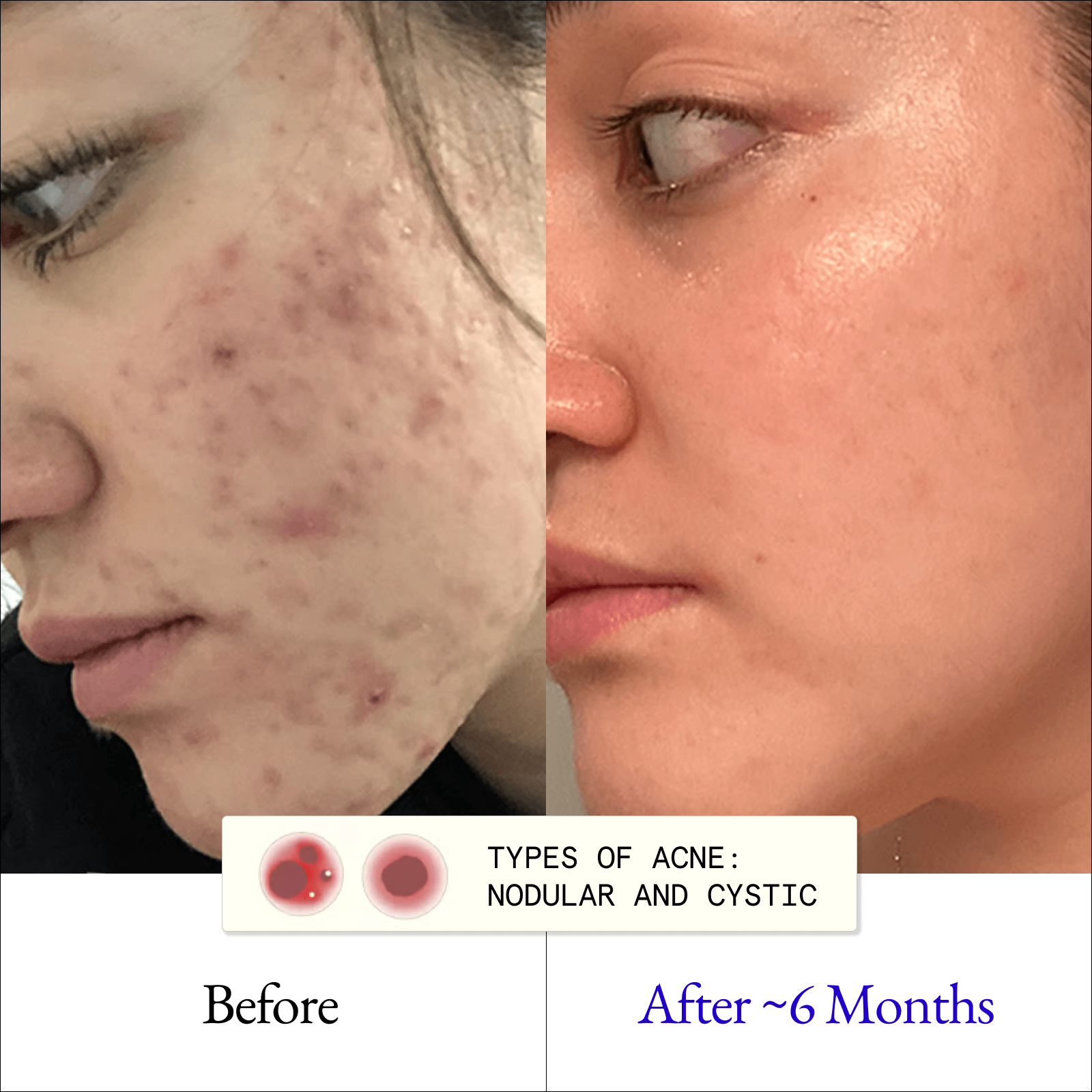 Clarify & Control Protocol (+ Free Eye Cream & Bag)