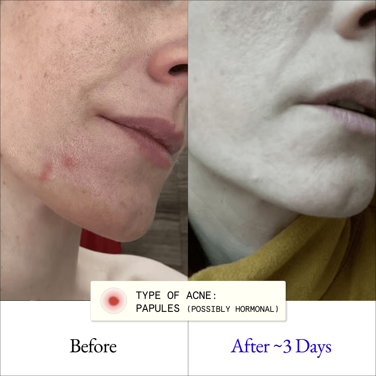 Clarify & Control Protocol (+ Free Eye Cream)