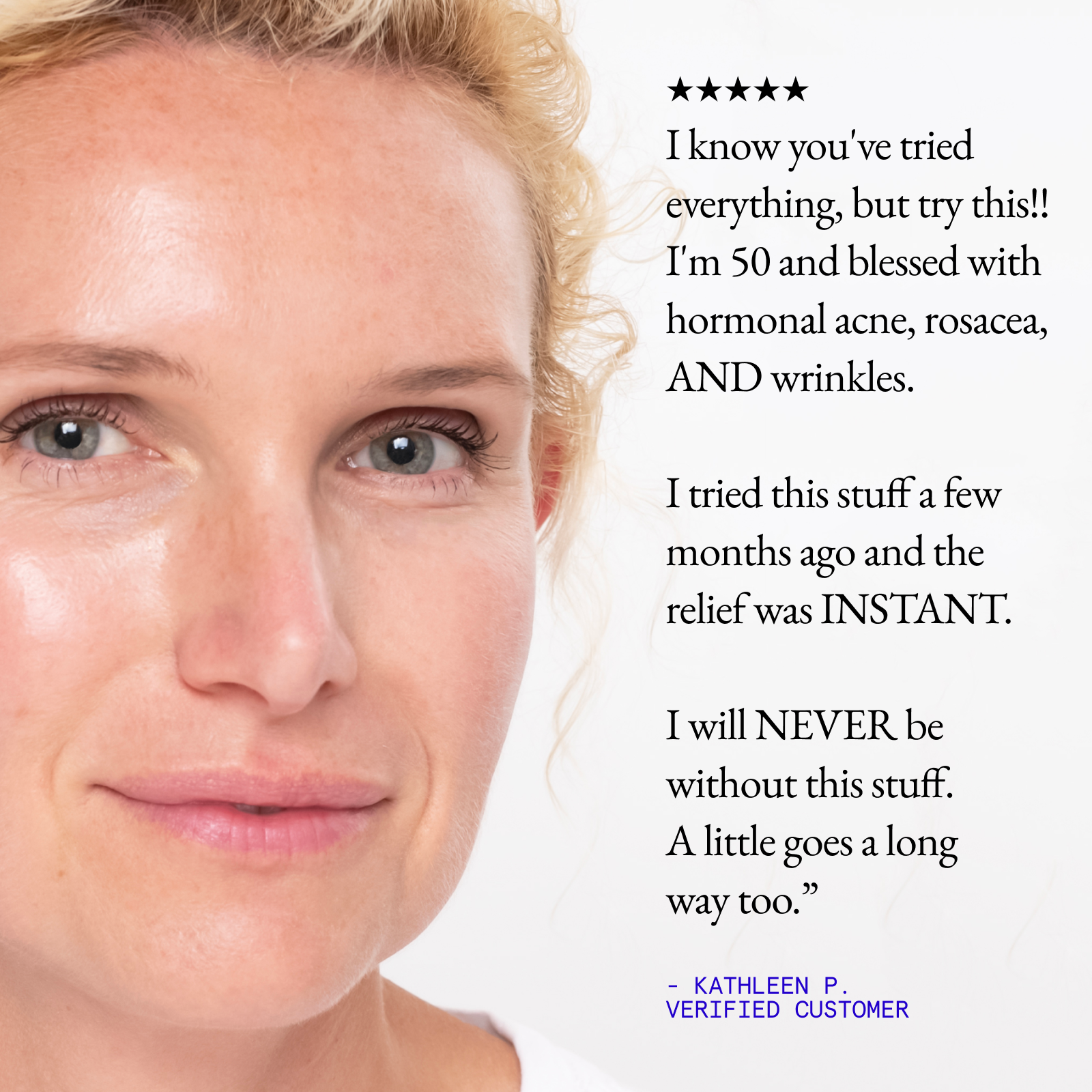 The Rewind Anti-Aging Kit